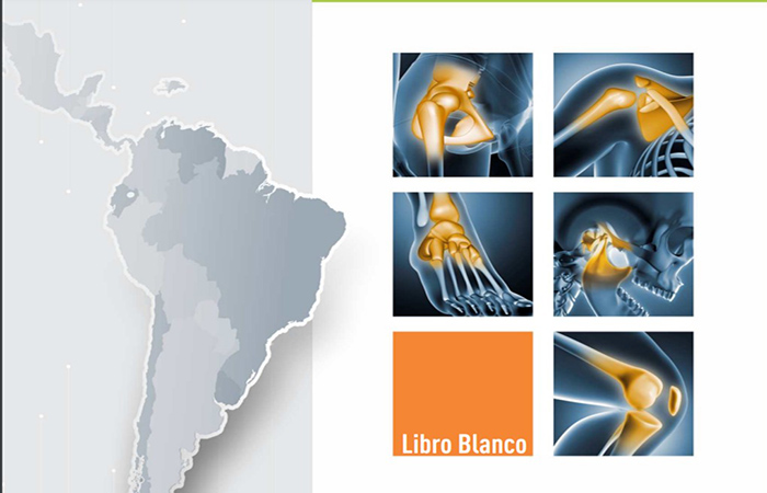 ecuador 221 la-osteoartritis-afecta-a-6-de-cada-10-pacientes-segun-la-oms-ecuador221.com_ La Osteoartritis afecta a 6 de cada 10 pacientes, según la OMS