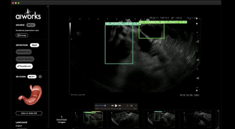 WhatsApp-Image-2024-07-22-at-21.52.24 Ieced Tricampeón en el congreso mundial de endoscopia digestiva en Seúl