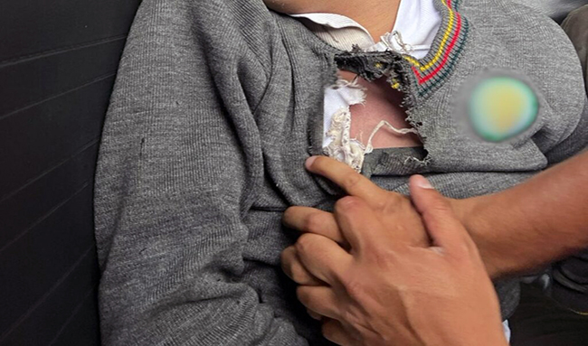 Rayo alcanzó y mató a un estudiante en Quito