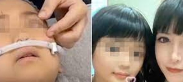 Niña japonesa de nueve años sufre cirugía de párpados