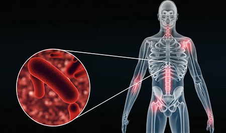 confirman-caso-de-tuberculosis-en-colegio-del-sur-de-guayaquil-ecuador221.com_.ec_ Confirman caso de tuberculosis en colegio del sur de Guayaquil